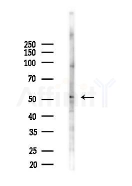 CLK4 Antibody - Western blot analysis of lysates from B16F10-LUC cells(starvation,24h treatment), using CLK4 Antibody at 1/1000 dilution.