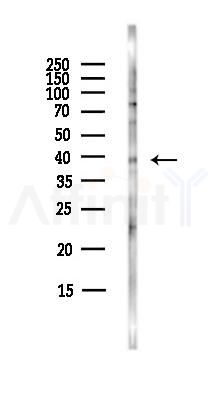 CNR2 Antibody - Western blot analysis of lysates from Hela cells(starvation,24h treatment), using CNR2 Antibody at 1/1000 dilution.