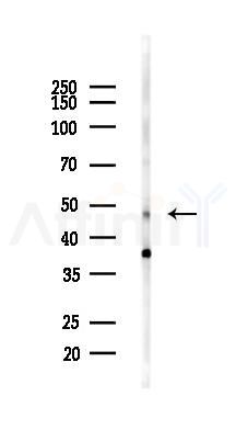 CtBP2 Antibody - Western blot analysis of lysates from A375 cells(heat-shock,45min treatment), using CtBP2 Antibody at 1/1000 dilution.