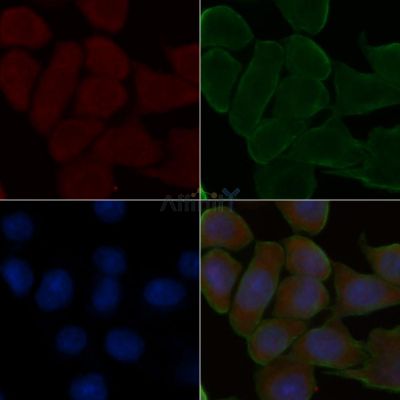 EIF4E3 Antibody - DF8652 staining Hela cells(30min of UV treatment) by IF/ICC.