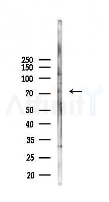 FAF1 Antibody - Western blot analysis of lysates from Hela cells(heat-shock, 45min treatment), using FAF1 Antibody at 1/1000 dilution.