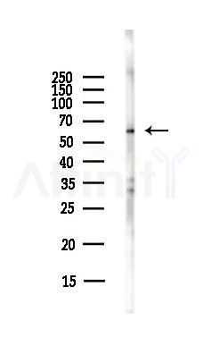 FZD7 Antibody - Western blot analysis of lysates from Hela cells(starvation,24h treatment), using FZD7 Antibody at 1/1000 dilution.