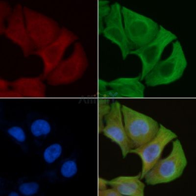 GLCTK Antibody - DF8661 staining Hela cells by IF/ICC.