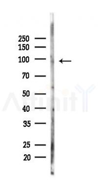HCN2 Antibody - Western blot analysis of lysates from HepG2 cells(heat-shock,45min treatment), using HCN2 Antibody at 1/1000 dilution.