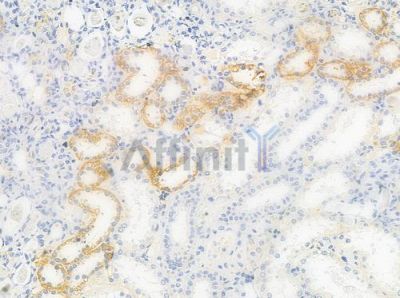 Hexokinase Type III Antibody - DF8665 at 1/100 staining human normal kidney tissue by IHC-P.