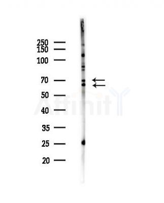 Ik3-1 Antibody - Western blot analysis of lysates from Hela cells(heat-shock,45min treatment), using Ik3-1 Antibody at 1/1000 dilution.