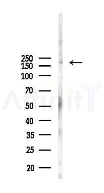 LAMB2 Antibody - Western blot analysis of lysates from 293 cells(heat-shock, 45min treatment), using LAMB2 Antibody at 1/1000 dilution.