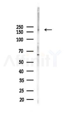 LAMB2 Antibody - Western blot analysis of lysates from Mouse testis, using LAMB2 Antibody at 1/1000 dilution.