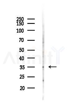 OR5H1 Antibody - Western blot analysis of lysates from 293 cells(UV,30min treatment), using OR5H1 Antibody at 1/1000 dilution.
