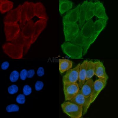 OR8B2/B3 Antibody - DF8704 staining Hela cells(30min of UV treatment) by IF/ICC.