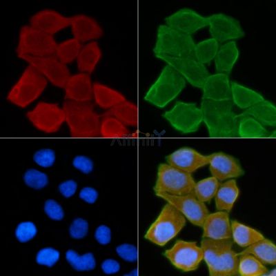 Prostate Stem Cell Antigen Antibody - DF8709 staining Hela cells(30min of UV treatment) by IF/ICC.