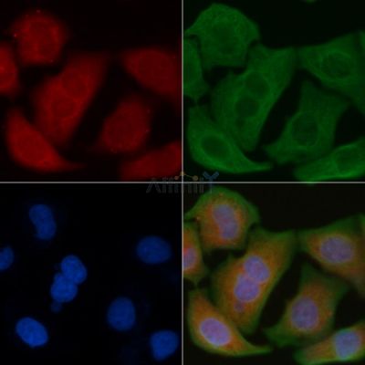 RNF19A Antibody - DF8717 staining Hela cells by IF/ICC.