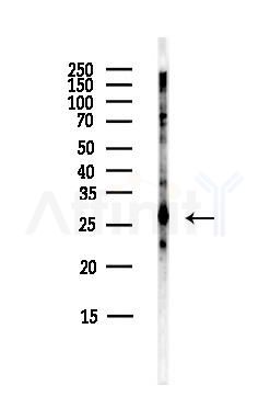 RPL14 Antibody - Western blot analysis of lysates from Mouse lung, using RPL14 Antibody at 1/1000 dilution.