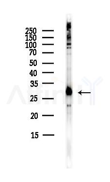 RPL14 Antibody - Western blot analysis of lysates from HepG2 cells(heat-shock,45min treatment), using RPL14 Antibody at 1/1000 dilution.