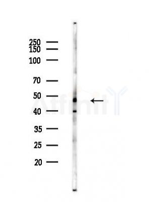 SOX8/9/17/18 Antibody - Western blot analysis of lysates from Hela cells(heat-shock,45min treatment), using SOX8/9/17/18 Antibody at 1/1000 dilution.
