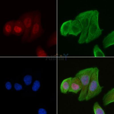 SRPK3 Antibody - DF8722 staining Hela cells(30min of UV treatment) by IF/ICC.