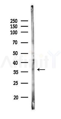 Tal1 Antibody - Western blot analysis of lysates from COLO205 cells(LPS,4h treatment), using Tal1 Antibody at 1/1000 dilution.