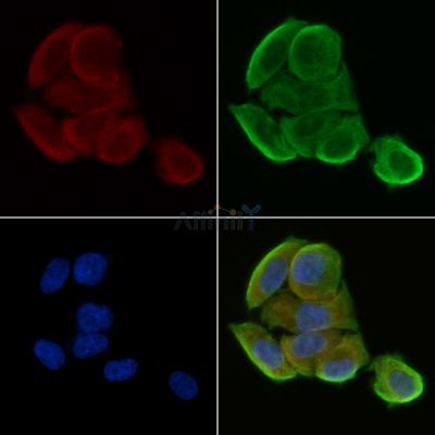 TMPRSS3 Antibody - DF8730 staining Hela cells(30min of UV treatment) by IF/ICC.