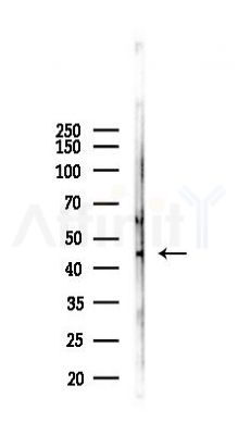 TMPRSS3 Antibody - Western blot analysis of lysates from Hela cells(heat-shock, 45min treatment), using TMPRSS3 Antibody at 1/1000 dilution.