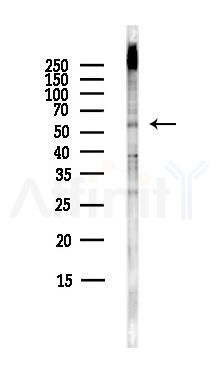 TPH2 Antibody - Western blot analysis of lysates from HepG2 cells(heat-shock,45min treatment), using TPH2 Antibody at 1/1000 dilution.