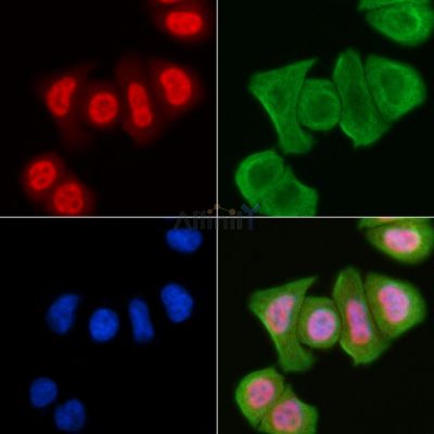 Phospho-JIP1 (Thr103) Antibody - DF8740 staining Hela cells(30min of UV treatment) by IF/ICC.