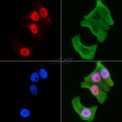 Phospho-WEE1 (Ser642) Antibody - DF8745 staining Hela cells(30min of UV treatment) by IF/ICC.