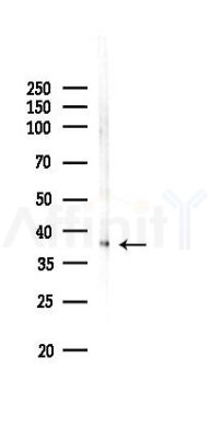 KLF8 Antibody - Western blot analysis of lysates from COLO205 cells(LPS,4h treatment), using KLF8 Antibody at 1/1000 dilution.