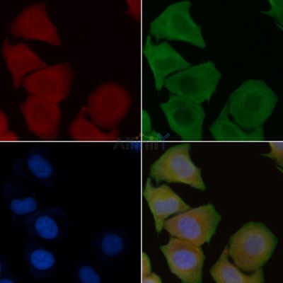 KITH_HHV1C Antibody - DF8778 staining Hela cells by IF/ICC.