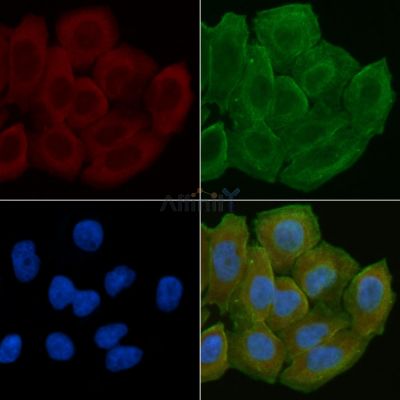 KITH_HHV1S Antibody - DF8779 staining Hela cells(30min of UV treatment) by IF/ICC.