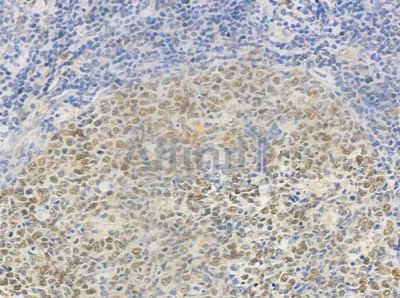 Gli3 Antibody - DF8784 at 1/100 staining human normal tonsil tissue by IHC-P.