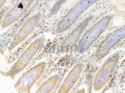 Gli3 Antibody - DF8784 at 1/100 staining human normal colon tissue by IHC-P.