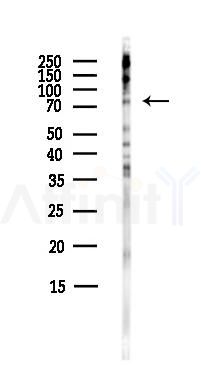 MTF1 Antibody - Western blot analysis of lysates from HepG2 cells(heat-shock,45min treatment), using MTF1 Antibody at 1/1000 dilution.