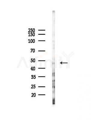 CCRN4L Antibody - Western blot analysis of lysates from Hela cells(UV,30min treatment), using CCRN4L Antibody at 1/1000 dilution.