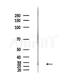 CT47A Antibody - Western blot analysis of lysates from PC12 cells(LPS,4h treatment), using CT47A Antibody at 1/1000 dilution.