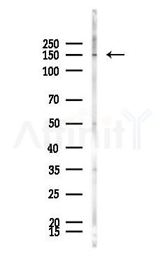 HIPK1 Antibody - Western blot analysis of lysates from HUVEC cells(heat-shock,45min treatment), using HIPK1 Antibody at 1/1000 dilution.