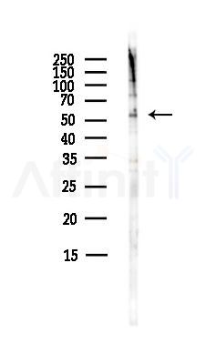 IP6K1 Antibody - Western blot analysis of lysates from HepG2 cells(heat-shock,45min treatment), using IP6K1 Antibody at 1/1000 dilution.