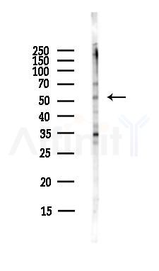 IP6K1 Antibody - Western blot analysis of lysates from Hela cells(starvation,24h treatment), using IP6K1 Antibody at 1/1000 dilution.