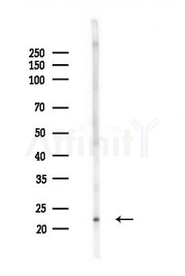 APOBEC3C Antibody - Western blot analysis of lysates from LoVo cells(heat-shock,45min treatment), using APOBEC3C Antibody at 1/1000 dilution.