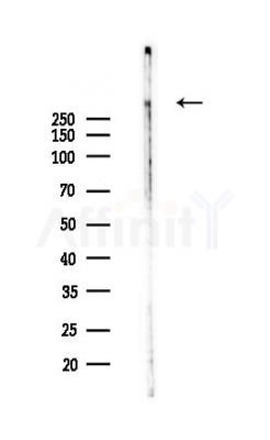 SRRM2 Antibody - Western blot analysis of lysates from 293 cells(heat-shock,45min treatment), using SRRM2 Antibody at 1/1000 dilution.