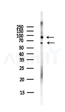 Collagen VIII  alpha 2 Antibody - Western blot analysis of lysates from Mouse lung, using Collagen VIII  alpha 2 Antibody at 1/1000 dilution.