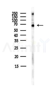 Collagen VIII  alpha 2 Antibody - Western blot analysis of lysates from HepG2 cells(heat-shock,45min treatment), using Collagen VIII  alpha 2 Antibody at 1/1000 dilution.