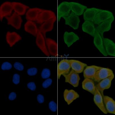 Collagen IX  alpha 1 Antibody - DF8904 staining Hela cells(30min of UV treatment) by IF/ICC.