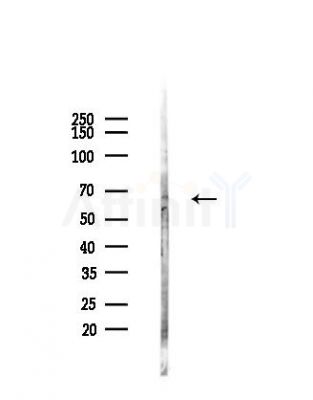 Collagen IX  alpha 2 Antibody - Western blot analysis of lysates from HepG2 cells(heat-shock,45min treatment), using Collagen IX  alpha 2 Antibody at 1/1000 dilution.