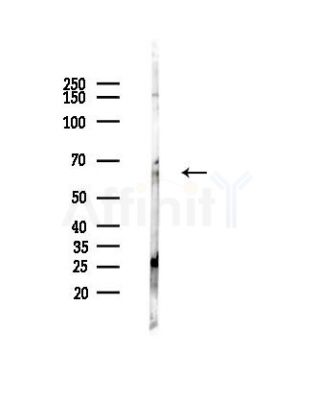 Collagen IX  alpha 2 Antibody - Western blot analysis of lysates from Mouse liver, using Collagen IX  alpha 2 Antibody at 1/1000 dilution.