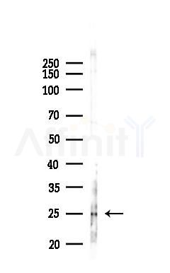 Cytochrome c Oxidase 3 Antibody - Western blot analysis of lysates from B16F10-LUC cells(UV,30min treatment), using Cytochrome c Oxidase 3 Antibody at 1/1000 dilution.