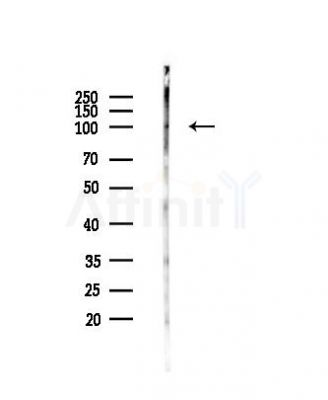 CDH26 Antibody - Western blot analysis of lysates from PC12 cells, using CDH26 Antibody at 1/1000 dilution.