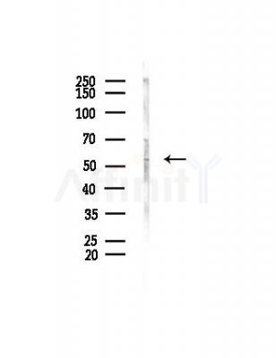 Cytochrome P450 46A1 Antibody - Western blot analysis of lysates from Hela cells(heat-shock, 45min treatment), using Cytochrome P450 46A1 Antibody at 1/1000 dilution.