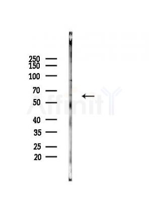 Cytochrome P450 4F3 Antibody - Western blot analysis of lysates from PC12 cells, using Cytochrome P450 4F3 Antibody at 1/1000 dilution.
