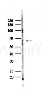CRY1 Antibody - Western blot analysis of lysates from HepG2 cells(heat-shock,45min treatment), using CRY1 Antibody at 1/1000 dilution.