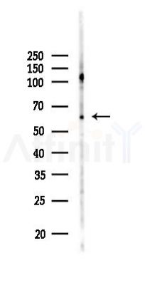 CRY1 Antibody - Western blot analysis of lysates from COLO205 cells(LPS,4h treatment), using CRY1 Antibody at 1/1000 dilution.